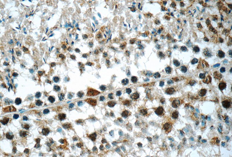 Immunohistochemistry of paraffin-embedded mouse testis tissue slide using Catalog No:109780(DDX10 Antibody) at dilution of 1:50 (under 40x lens)