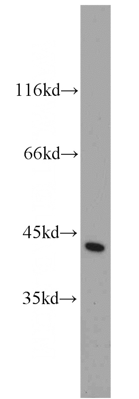HeLa cells were subjected to SDS PAGE followed by western blot with Catalog No:108934(CAPG antibody) at dilution of 1:1000