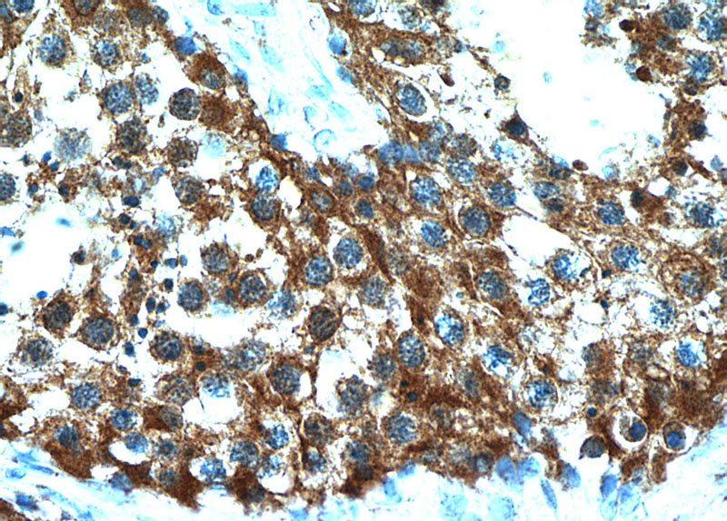 Immunohistochemical of paraffin-embedded human testis using Catalog No:111577(HYAL3 antibody) at dilution of 1:50 (under 40x lens)