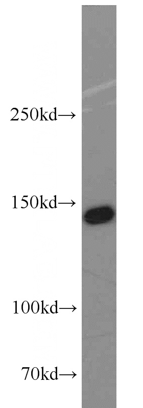 A431 cells were subjected to SDS PAGE followed by western blot with Catalog No:115437(SMC1A antibody) at dilution of 1:1000