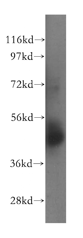 human placenta tissue were subjected to SDS PAGE followed by western blot with Catalog No:113389(NSUN5 antibody) at dilution of 1:500