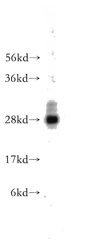 mouse liver tissue were subjected to SDS PAGE followed by western blot with Catalog No:113173(NGFRAP1 antibody) at dilution of 1:400