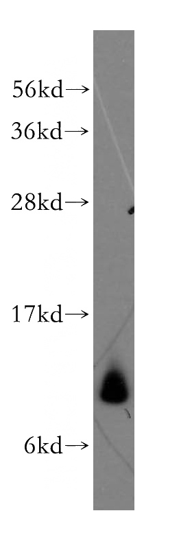 human liver tissue were subjected to SDS PAGE followed by western blot with Catalog No:112824(MRPL34 antibody) at dilution of 1:2000