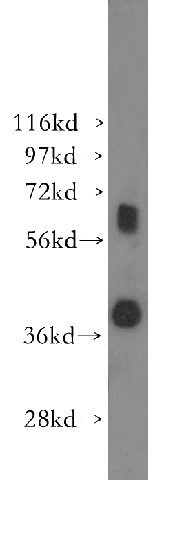 human duodenum tissue were subjected to SDS PAGE followed by western blot with Catalog No:115648(SPRY2 antibody) at dilution of 1:500