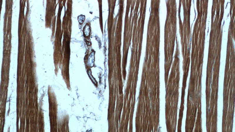 Immunohistochemistry of paraffin-embedded human skeletal muscle tissue slide using Catalog No:108007(PRKAA2 Antibody) at dilution of 1:50 (under 10x lens)