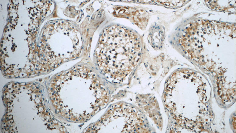 Immunohistochemistry of paraffin-embedded human testis slide using Catalog No:114644(RGS17 Antibody) at dilution of 1:50