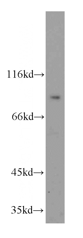 HepG2 cells were subjected to SDS PAGE followed by western blot with Catalog No:115439(SMYD4 antibody) at dilution of 1:300