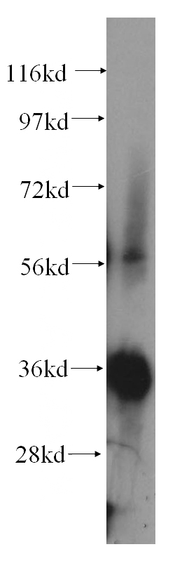 human heart tissue were subjected to SDS PAGE followed by western blot with Catalog No:113192(NIT1 antibody) at dilution of 1:100
