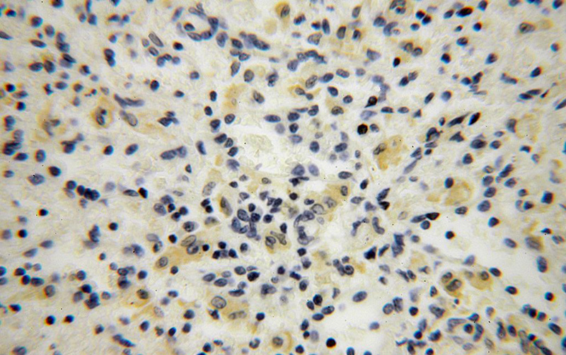 Immunohistochemical of paraffin-embedded human spleen using Catalog No:108177(ARHGAP4 antibody) at dilution of 1:100 (under 40x lens)