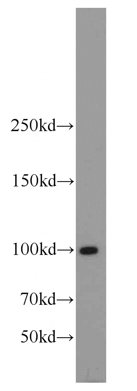 mouse testis tissue were subjected to SDS PAGE followed by western blot with Catalog No:112222(LIG4 antibody) at dilution of 1:600