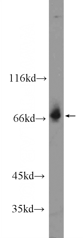 PC-3 cells were subjected to SDS PAGE followed by western blot with Catalog No:117064(ZKSCAN1 Antibody) at dilution of 1:600