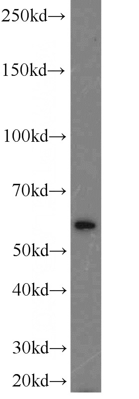 mouse testis tissue were subjected to SDS PAGE followed by western blot with Catalog No:113972(PLK5P antibody) at dilution of 1:300