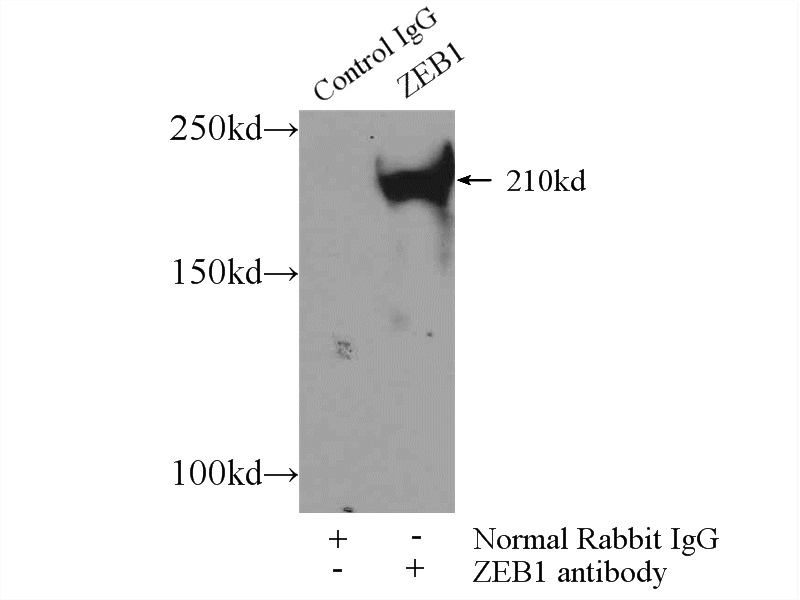 IP Result of anti-ZEB1 (IP:Catalog No:117037, 4ug; Detection:Catalog No:117037 1:500) with MCF-7 cells lysate 4000ug.