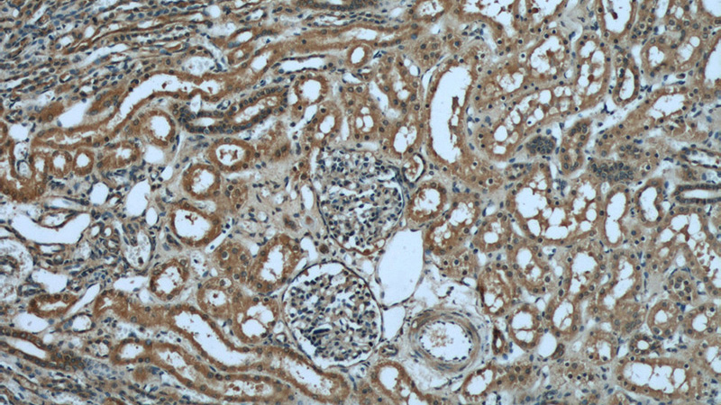 Immunohistochemical of paraffin-embedded human kidney using Catalog No:111149(GPX4 antibody) at dilution of 1:50 (under 10x lens)