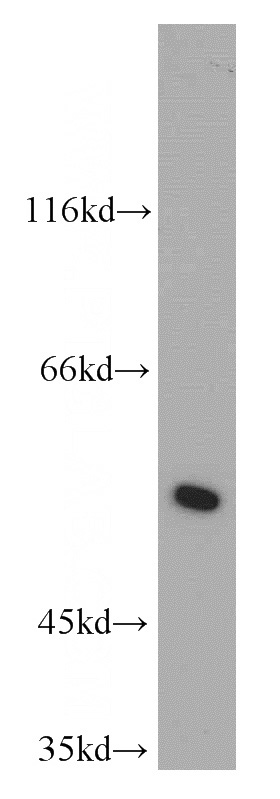 L02 cells were subjected to SDS PAGE followed by western blot with Catalog No:112317(LRDD antibody) at dilution of 1:300