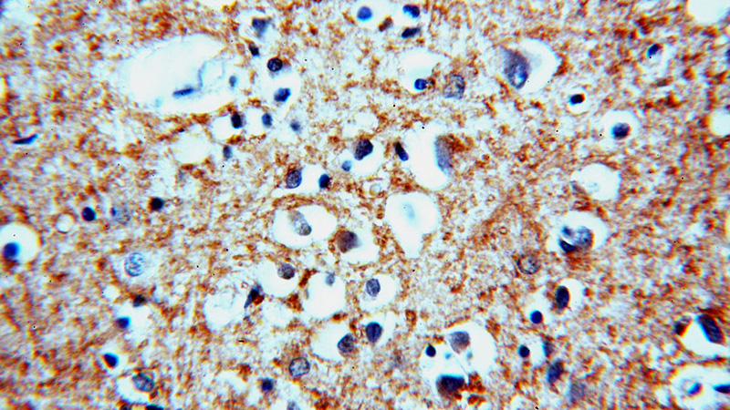 Immunohistochemical of paraffin-embedded human brain using Catalog No:113723(PSPN-Specific antibody) at dilution of 1:50 (under 40x lens)