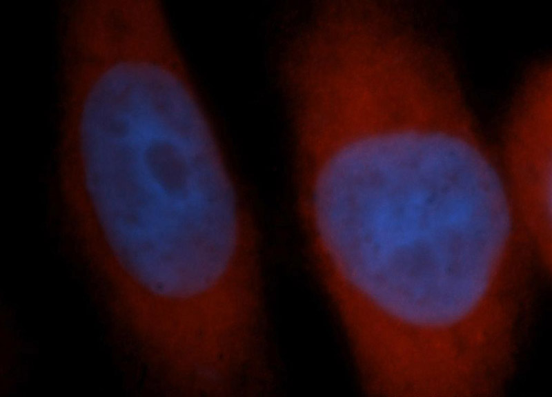 Immunofluorescent analysis of Hela cells, using TTF2 antibody Catalog No:116477 at 1:50 dilution and Rhodamine-labeled goat anti-rabbit IgG (red). Blue pseudocolor = DAPI (fluorescent DNA dye).