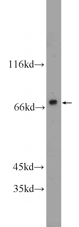MCF-7 cells were subjected to SDS PAGE followed by western blot with Catalog No:113999(POLD3 Antibody) at dilution of 1:300