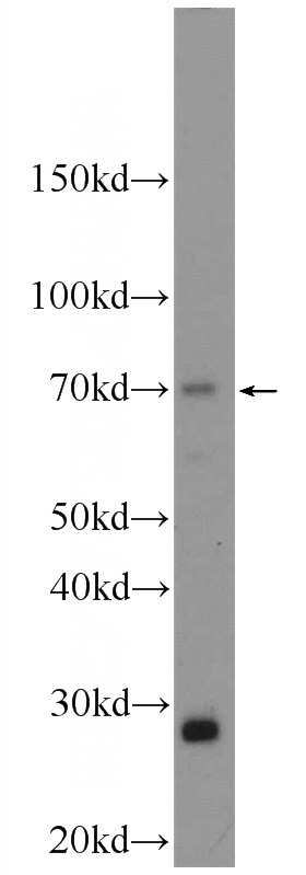 mouse spleen tissue were subjected to SDS PAGE followed by western blot with Catalog No:108292(ATG16L2 Antibody) at dilution of 1:1000