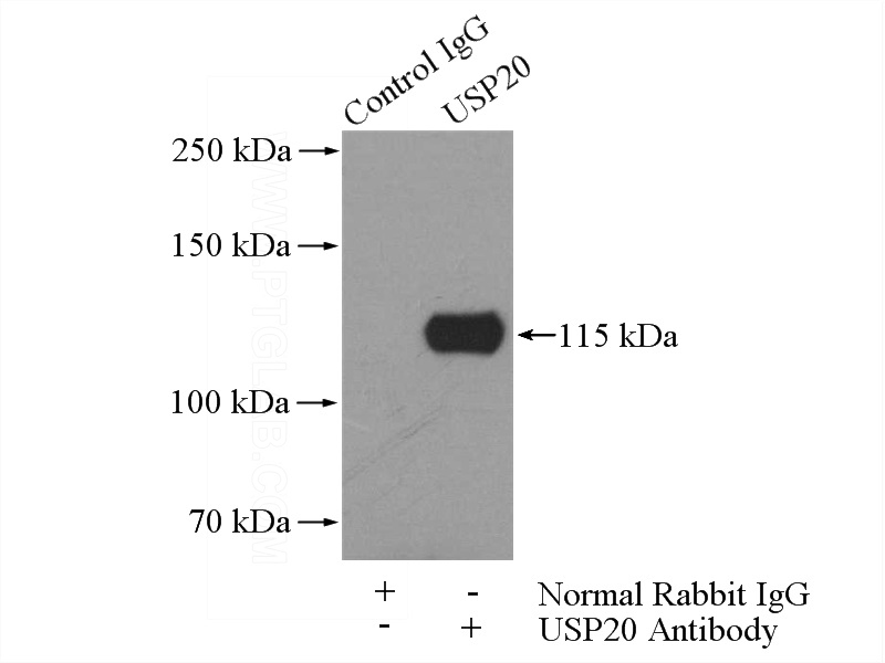 IP Result of anti-USP20 (IP:Catalog No:116598, 4ug; Detection:Catalog No:116598 1:500) with HeLa cells lysate 1200ug.