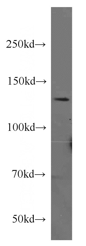 human brain tissue were subjected to SDS PAGE followed by western blot with Catalog No:109719(CTCF antibody) at dilution of 1:500