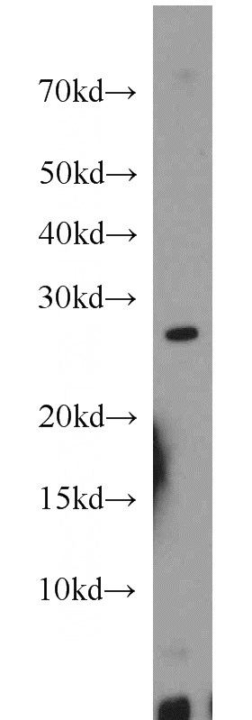mouse skeletal muscle tissue were subjected to SDS PAGE followed by western blot with Catalog No:112909(MXD1 antibody) at dilution of 1:800