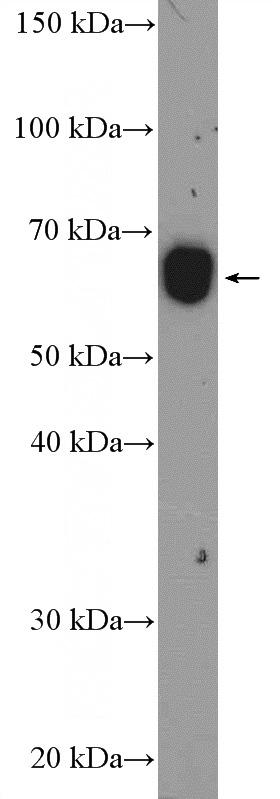 rat skeletal muscle tissue were subjected to SDS PAGE followed by western blot with Catalog No:116854(WDR1 Antibody) at dilution of 1:600