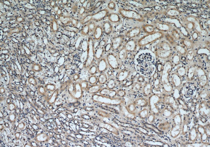 Immunohistochemical of paraffin-embedded human kidney using Catalog No:116576(Uroguanylin antibody) at dilution of 1:50 (under 10x lens)