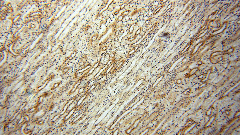 Immunohistochemical of paraffin-embedded human kidney using Catalog No:108928(CAMSAP1L1 antibody) at dilution of 1:100 (under 10x lens)