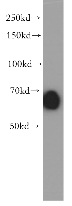 Jurkat cells were subjected to SDS PAGE followed by western blot with Catalog No:111834(IRF2BP2 antibody) at dilution of 1:500