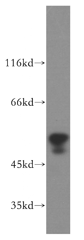A375 cells were subjected to SDS PAGE followed by western blot with Catalog No:111311(HFE antibody) at dilution of 1:300