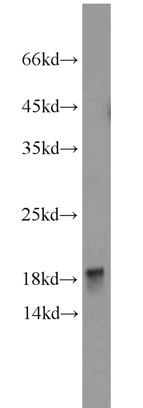 mouse heart tissue were subjected to SDS PAGE followed by western blot with Catalog No:114041(POLR2D antibody) at dilution of 1:800