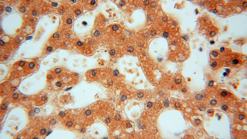 Immunohistochemical of paraffin-embedded human liver using Catalog No:108616(C18orf55 antibody) at dilution of 1:100 (under 40x lens)