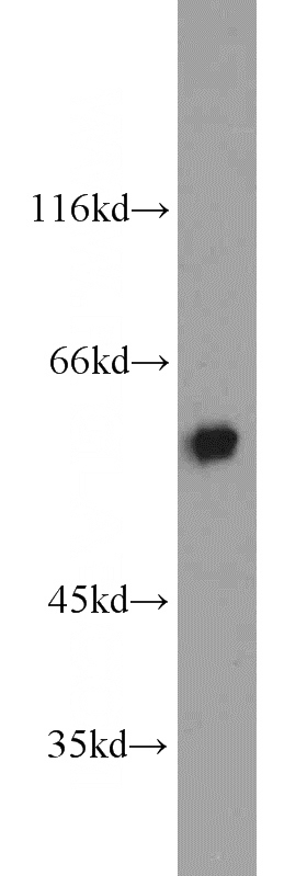 PC-3 cells were subjected to SDS PAGE followed by western blot with Catalog No:111913(KAT5 antibody) at dilution of 1:1000