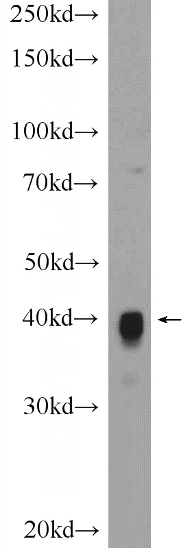 rat heart tissue were subjected to SDS PAGE followed by western blot with Catalog No:109330(CKMT1A Antibody) at dilution of 1:1500