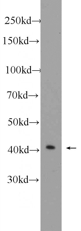 K-562 cells were subjected to SDS PAGE followed by western blot with Catalog No:114229(PRPF38A Antibody) at dilution of 1:300