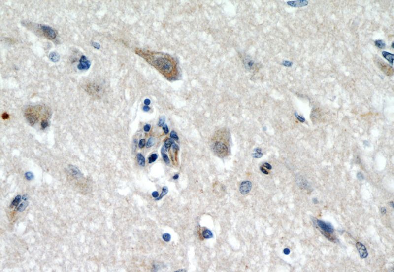 Immunohistochemical of paraffin-embedded human brain using Catalog No:113536(DCTN1 antibody) at dilution of 1:50 (under 40x lens)
