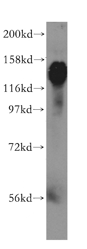 HEK-293 cells were subjected to SDS PAGE followed by western blot with Catalog No:111014(GOLGA2,GM130 antibody) at dilution of 1:1000