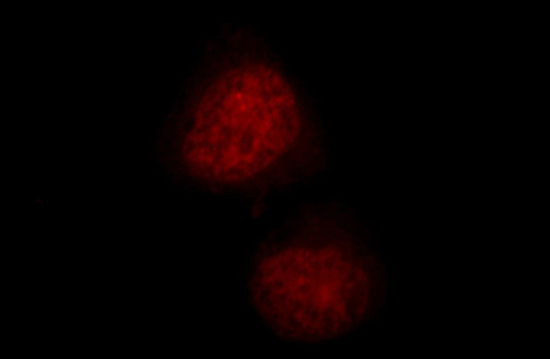 Immunofluorescent analysis of Hela cells, using TCEB3 antibody Catalog No:115902 at 1:25 dilution and Rhodamine-labeled goat anti-rabbit IgG (red).
