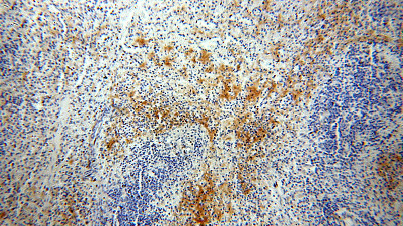 Immunohistochemical of paraffin-embedded human spleen using Catalog No:107773(ADAP2 antibody) at dilution of 1:50 (under 10x lens)