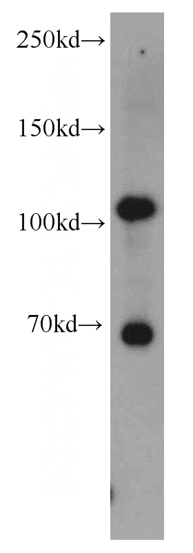 Jurkat cells were subjected to SDS PAGE followed by western blot with Catalog No:111307(HK2 antibody) at dilution of 1:1000