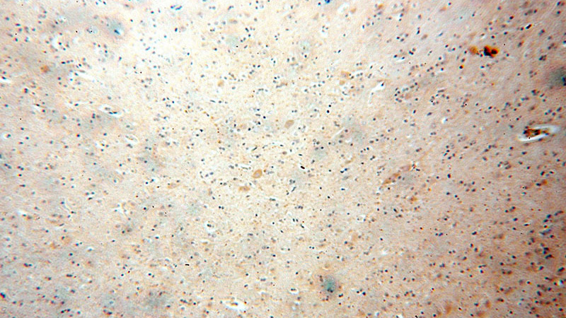 Immunohistochemical of paraffin-embedded human brain using Catalog No:111924(KCNAB1 antibody) at dilution of 1:100 (under 10x lens)