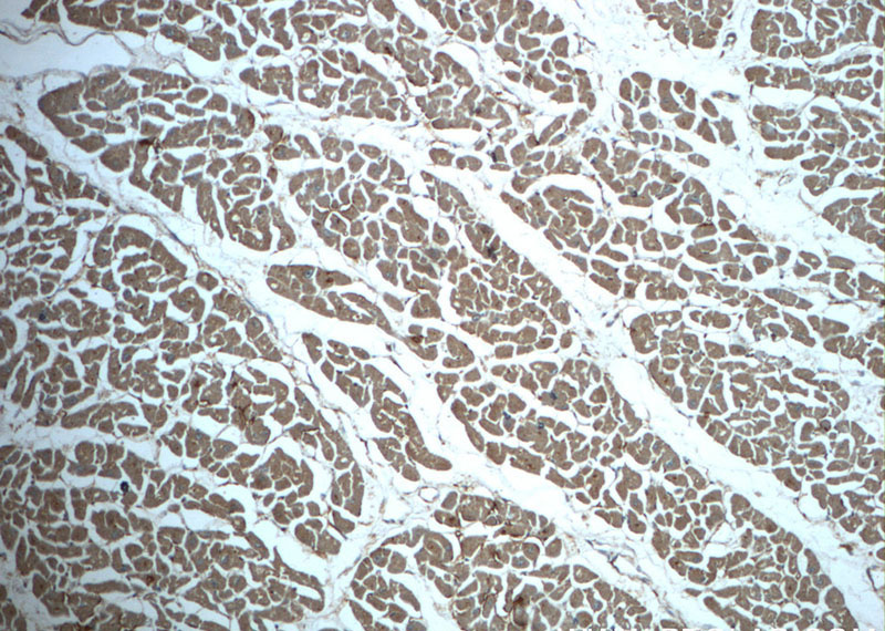 Immunohistochemistry of paraffin-embedded human heart slide using Catalog No:116320(TRIM54 Antibody) at dilution of 1:50