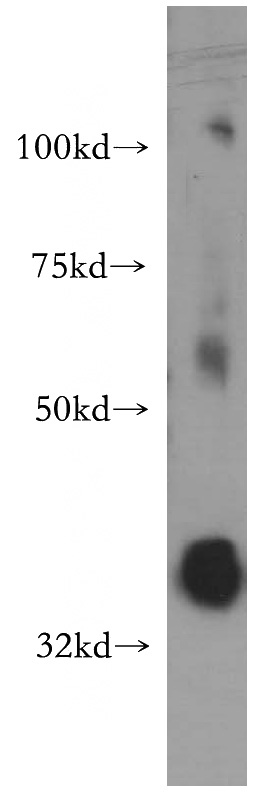 HeLa cells were subjected to SDS PAGE followed by western blot with Catalog No:113890(PIGA antibody) at dilution of 1:500