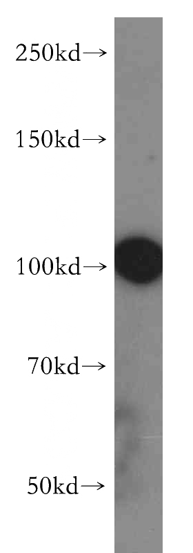 A549 cells were subjected to SDS PAGE followed by western blot with Catalog No:112428(MAP7 antibody) at dilution of 1:500
