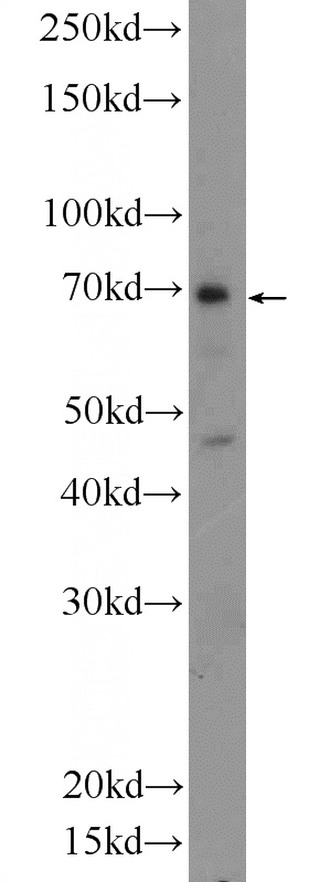 mouse ovary tissue were subjected to SDS PAGE followed by western blot with Catalog No:110584(FAM20C Antibody) at dilution of 1:300