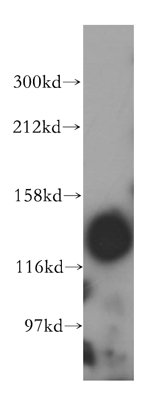 HeLa cells were subjected to SDS PAGE followed by western blot with Catalog No:115081(SEC31A antibody) at dilution of 1:500