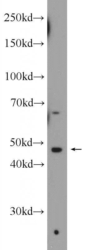 Jurkat cells were subjected to SDS PAGE followed by western blot with Catalog No:115605(SSB Antibody) at dilution of 1:300