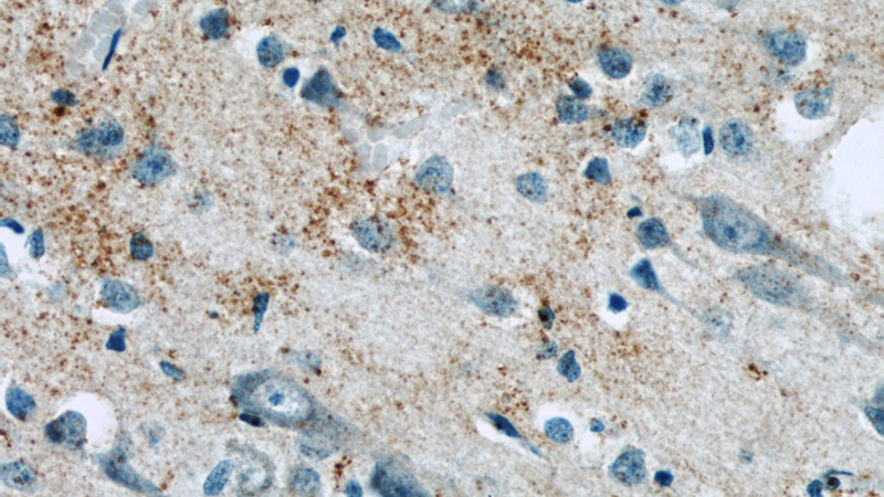 Immunohistochemistry of paraffin-embedded human brain slide using Catalog No:117210(BNP Antibody) at dilution of 1:50