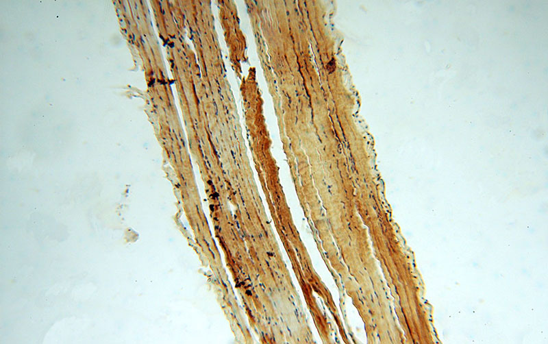 Immunohistochemical of paraffin-embedded human skeletal muscle using Catalog No:112004(KIF1B antibody) at dilution of 1:50 (under 10x lens)